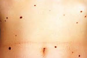 Immagine dermatologia clinica Beatrice Pietricola
