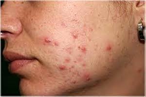 Immagine dermatologia clinica Beatrice Pietricola