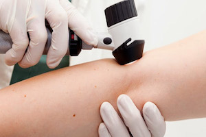 Immagine dermatologia diagnostica Dott.ssa Beatrice Pietricola