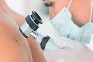 Immagine dermatologia diagnostica Dott.ssa Beatrice Pietricola