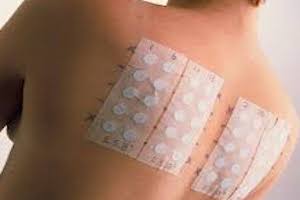Immagine dermatologia diagnostica Dott.ssa Beatrice Pietricola