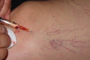 Immagine dermoestetica corpo Dott.ssa Beatrice Pietricola