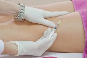Immagine dermoestetica corpo Dott.ssa Beatrice Pietricola